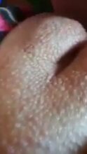 Pepeng Na-Goosebumps